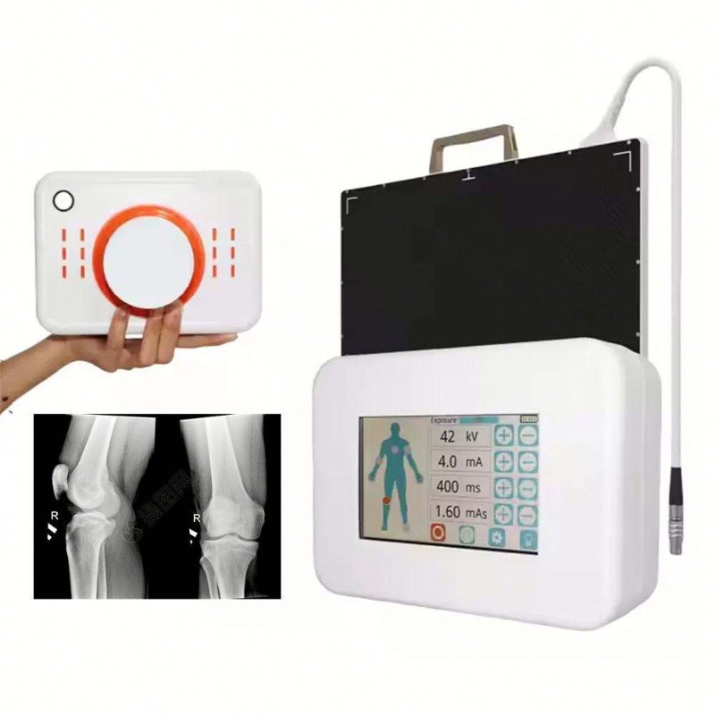 Portable Small Size Hand-Held  - Veterinary X-Ray reseña y precio