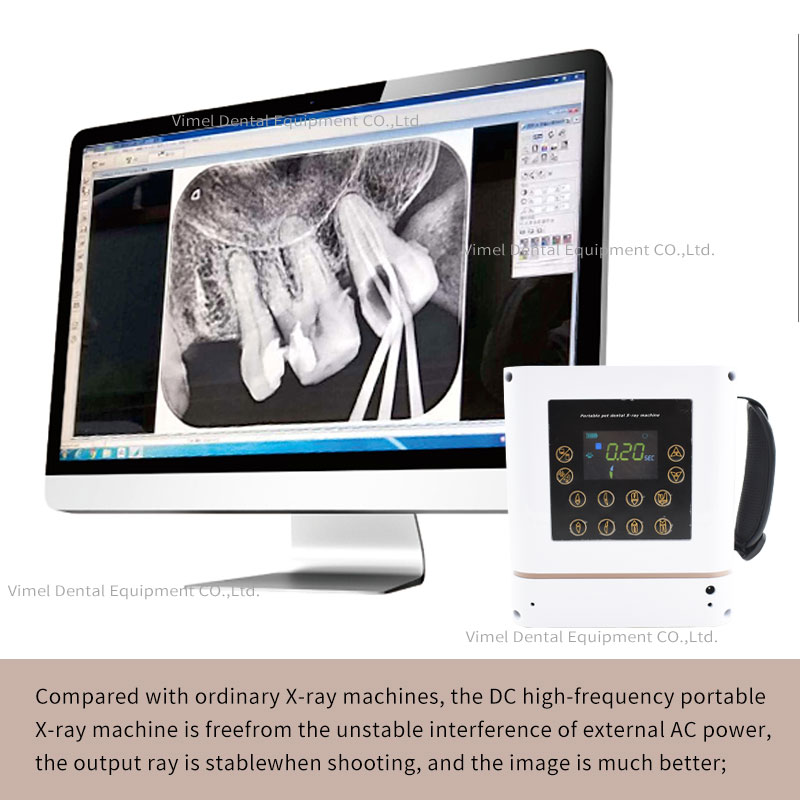 Dental X Ray Equipment 60KV 30 - Veterinary X-Ray reseña y precio
